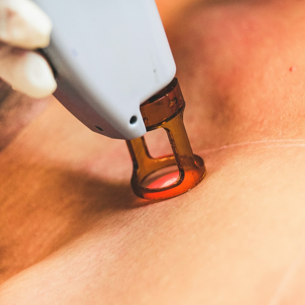 Ponteira de laser sobre a pele